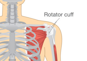 San Antonio Chiropractor rotator cuff